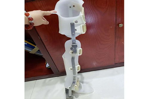 假肢與矯形器的使用周期與更換指南 科學(xué)維護，保障生活品質(zhì)